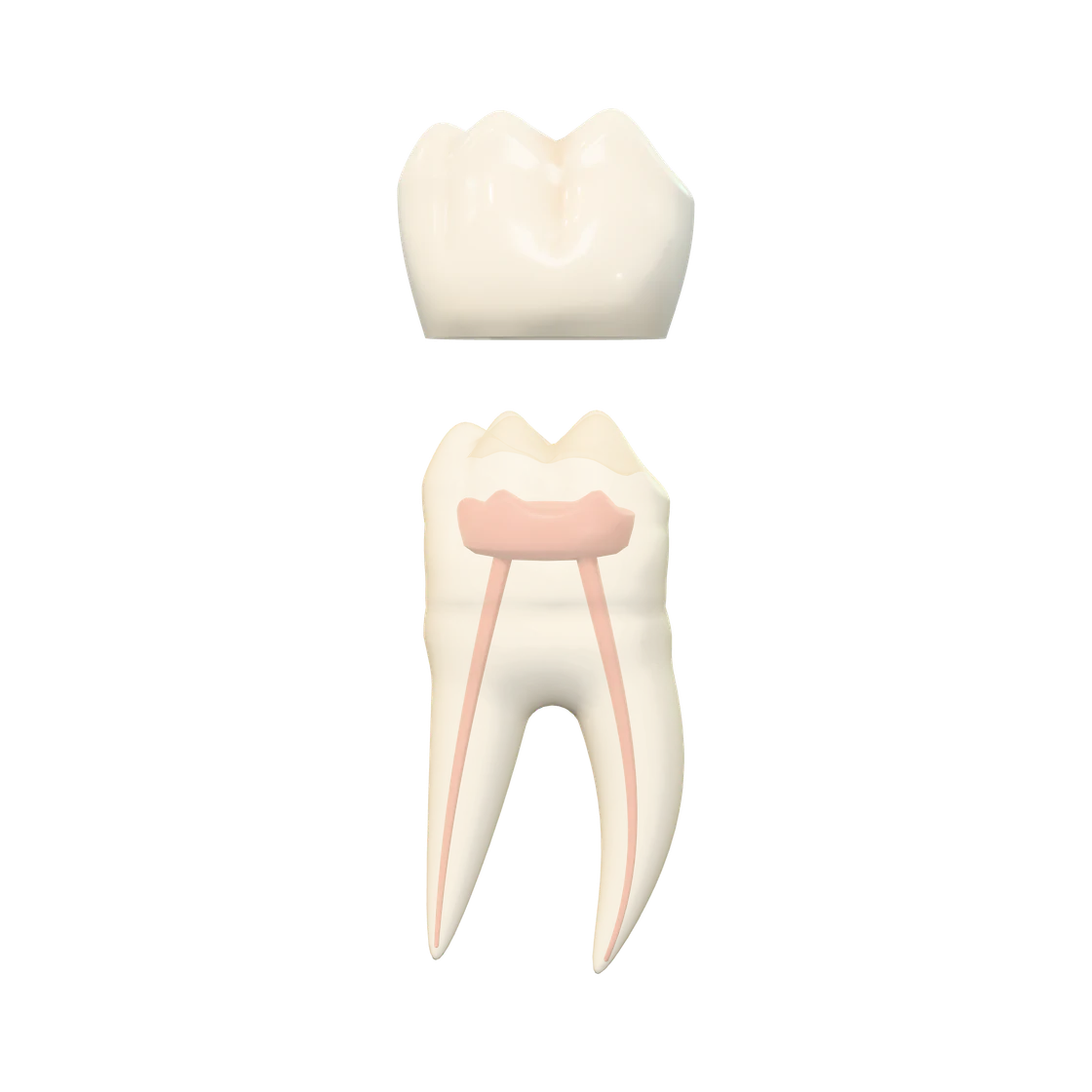 Exploded view of a lower first molar (tooth 46): the enamel cap lifted off the crown, the dentin shown translucent over the pink pulp chamber and its canals, and the two roots.